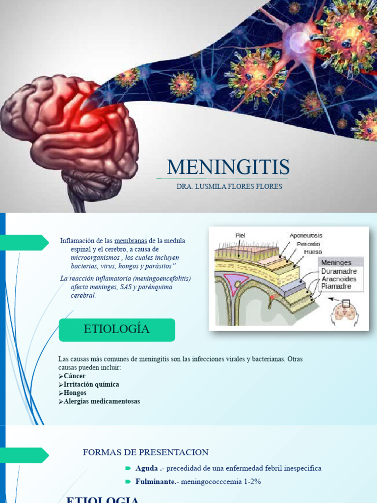 Meningitis Bacteriana en Adultos | PDF | Meningitis | Ciencias de la Salud