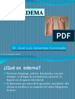 EDEMA