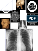 Bases Elementaires Semiologie Radiologique Uam