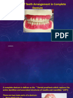Teeth Arrangement