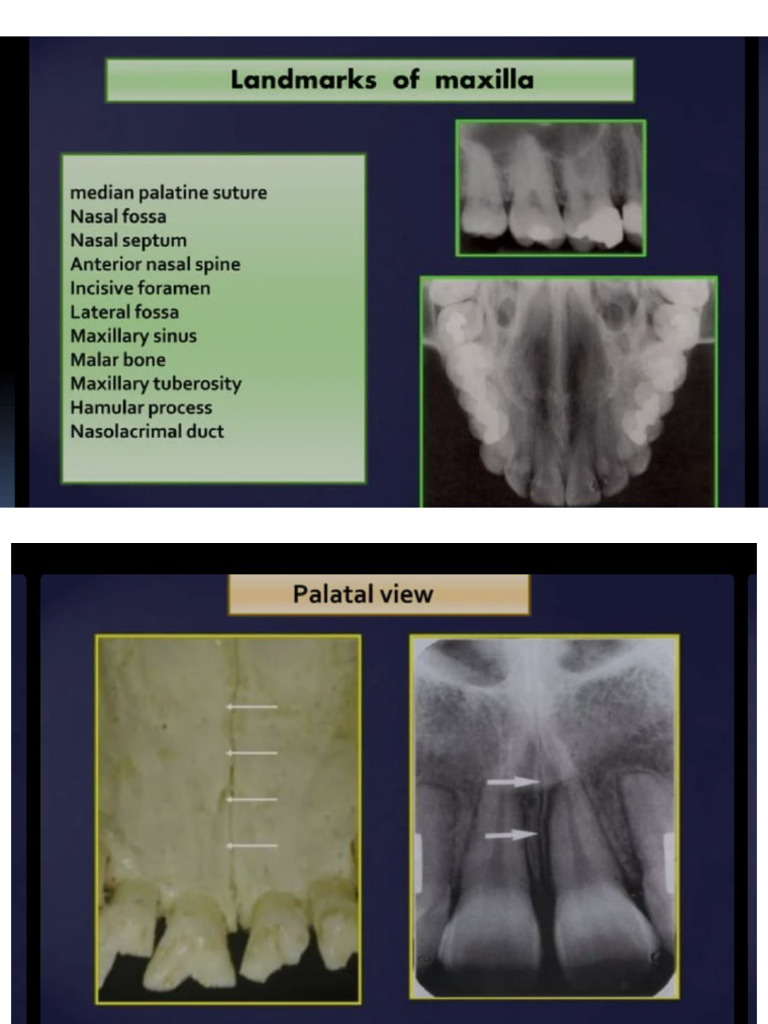 ANATOMICAL LANDMARKS IN DENTAL RADIOLOGY visual data 2