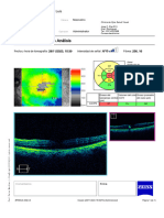 Hc8866-Oct Macular Ao-20231129-154053-0004