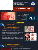 Laringitis