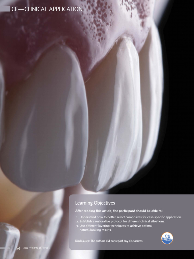 Layering Techniques for Composite Veneers | PDF | Tooth Enamel | Dental ...
