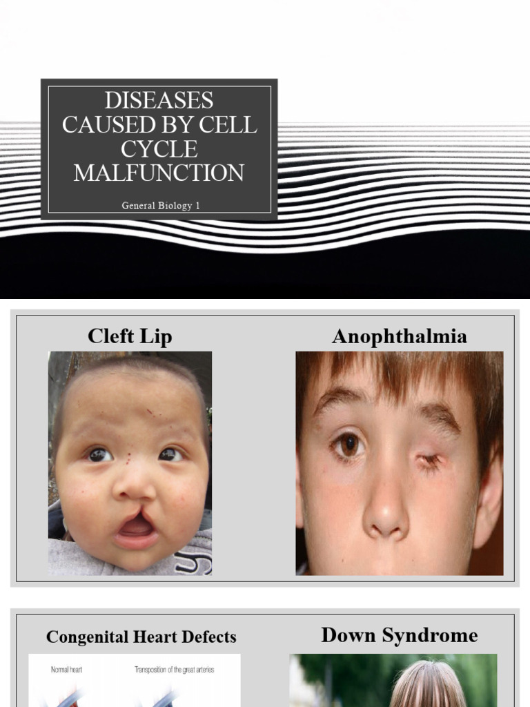 Lesson 9 Diseases Caused by Cell Cycle Malfunction PDF