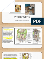 4 Peritonitis - 2023