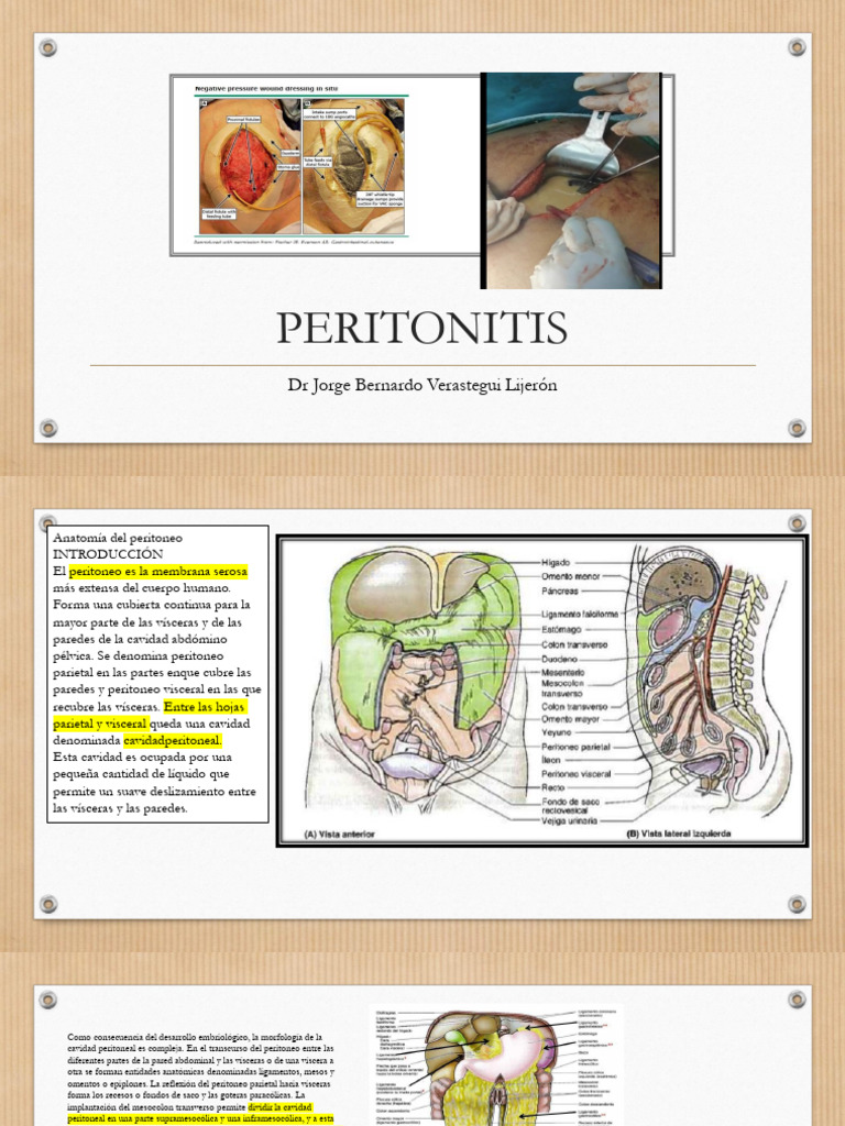 Anatomía y fisiopatología de la peritonitis | PDF | Inflamación ...