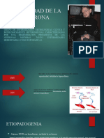 Enfermedad D de La Motoneurona