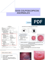 Hallazgos Colposcopicos Annormales