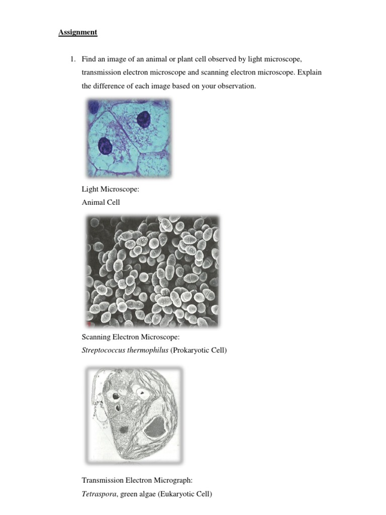 Assignment: Streptococcus Thermophilus (Prokaryotic Cell) | PDF ...