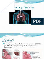 Enfisema Pulmonar