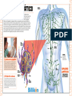 INFOGRAFIA Sistema Linfatico BILLIKEN