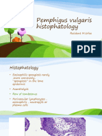 Pemphigus Vulgaris Linear IgA Dermatitis