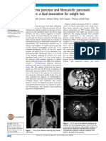 Carcinoma Pancreas and Fibrocalcific Pancreatic Diabetes A Dual Association For Weight Loss