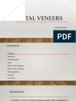 Dental Veneers