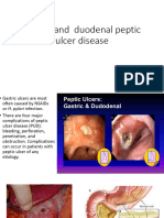 2 Gastric and Duodenal Peptic Ulcer Disease 2