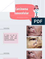 Carcinoma Basocelular