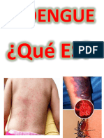 DENGUE