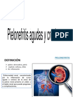 Pielonefritis Aguda y Cronica Ok