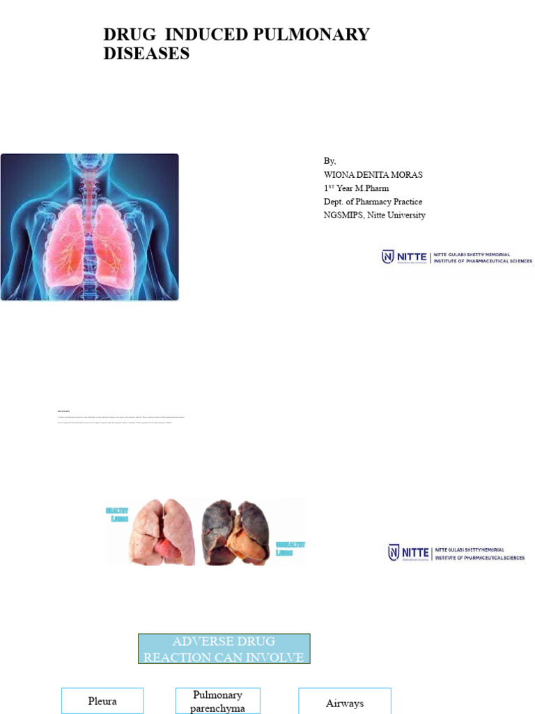 Drug Induced Pulmonary Diseases | PDF | Lung | Respiratory Diseases