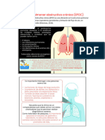 Enfermedad Pulmonar Obstructiva Crónica