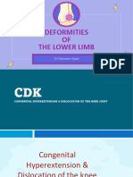 Deformities OF The Lower Limb: DR - Tehreem Nasir