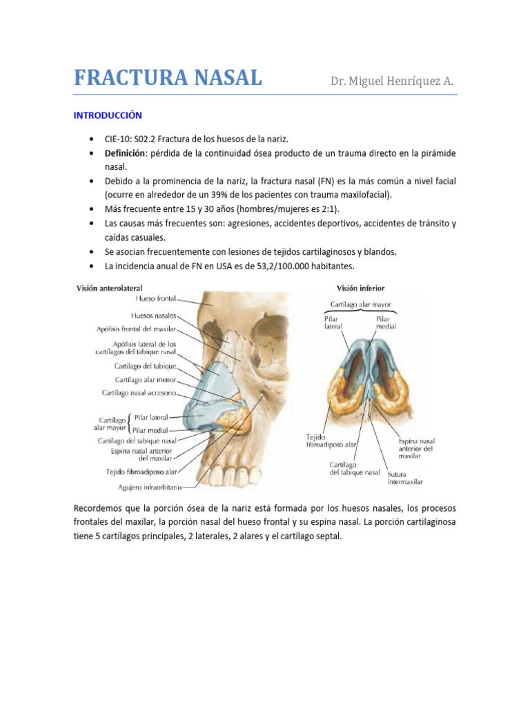 03 Fractura Nasal DR Henriquez | PDF | Medicina CLINICA ...
