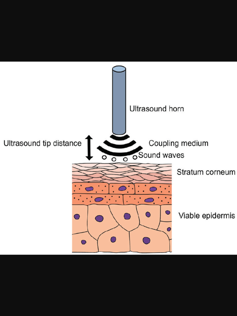 Schematicrepresentationoflowfrequencyultrasoundapplicationon