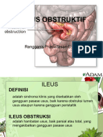 Ileus Obstruktif