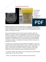 Intrusión Cerebral - El Descubrimiento Del Gusano