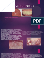 Caso Clinico Protesis