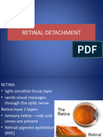 retinal detachment