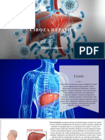 Ciroza Hepatica