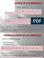 Tema 3 Trastornos Del Ritmo Cardiaco 2