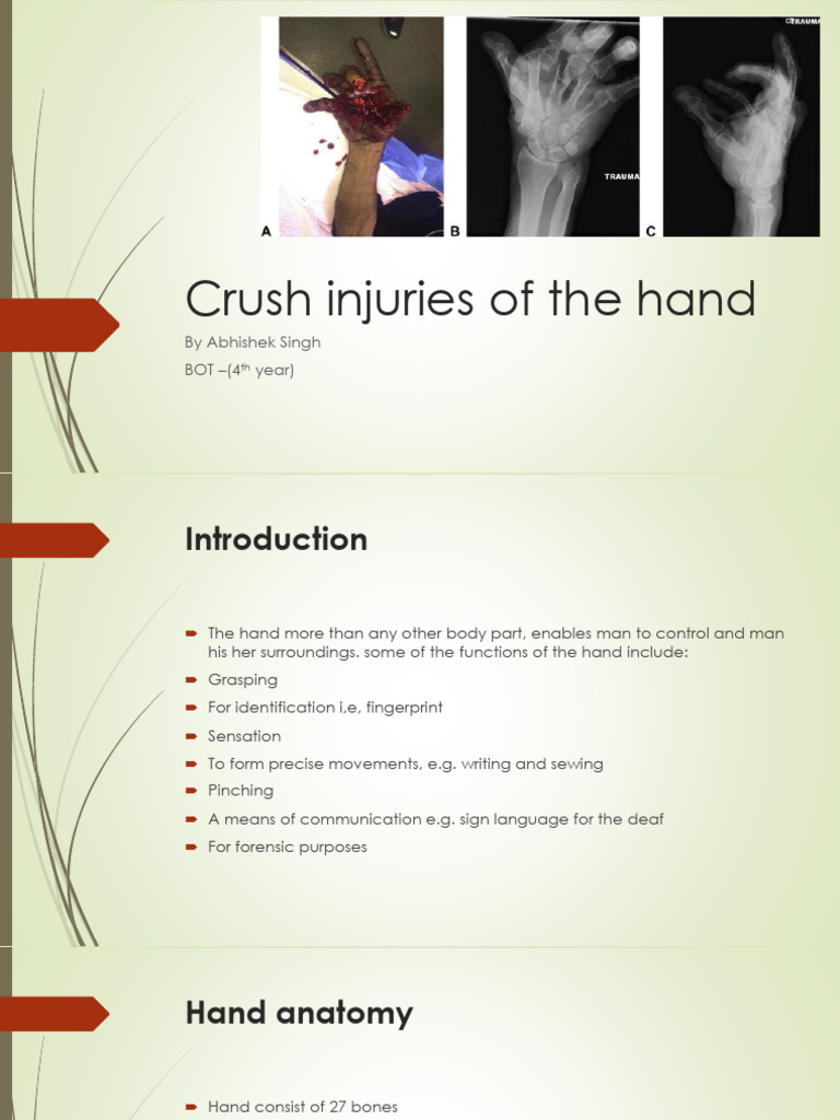 Crush Injuries of The Hand | PDF