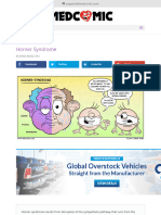 Horner Syndrome - Medcomic