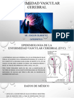 Enfermedad Vascular Cerebral