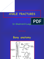 Ankle Fractures