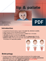 Cleft Lip & Palate