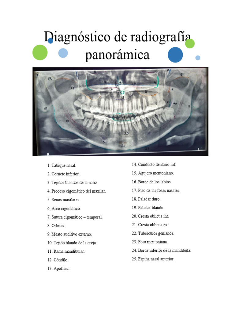 Análisis de Radiografía Panorámica Dental | PDF