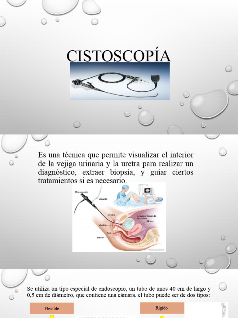 Cistoscopía: Procedimiento y Usos | PDF | Especialidades Medicas ...