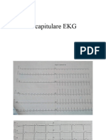 Recapitulare Ekg