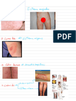 Skin Manefestations of Systemic Disorders