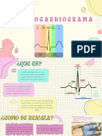 Electrocardiograma