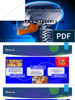 Fractura Mandibular