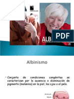 Albinismo...