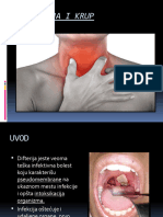 Difterija I Krup