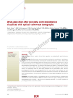 Radu. Strut Aposition After Coronary Stent Implantation Visualised With OCT. Eurointerv 2010