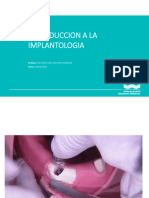14KKUNW Introducción A La Implantologíammmm (Autoguardado)