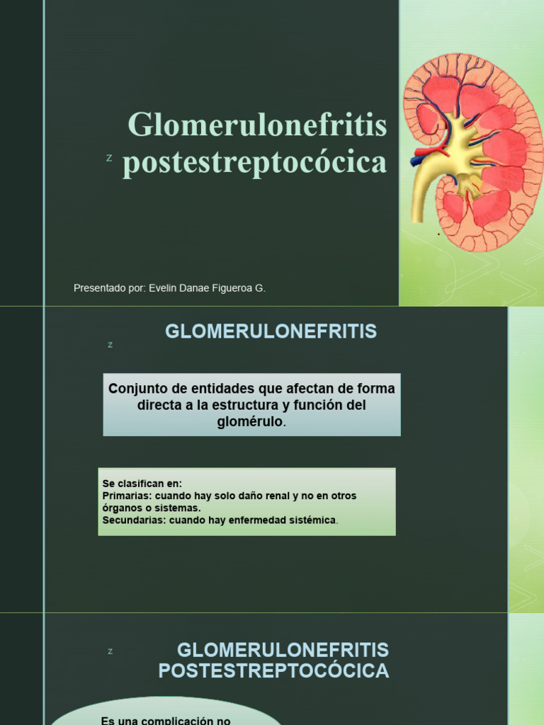 Glomerulonefritis Postestreptocócica PDF Nefrología Medicina CLINICA